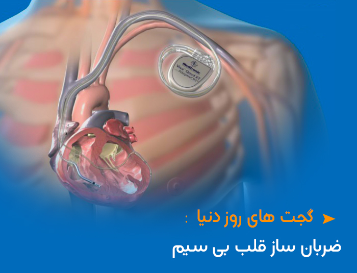 ساخت ضربان ساز قلب بی سیم بدون نیاز به باتری و قابلیت جذب در بدن 
